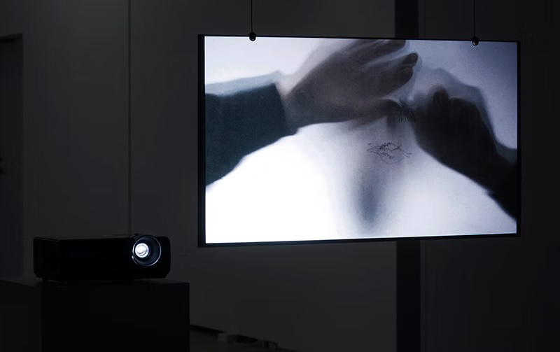 Anatomy of the eyes wide open